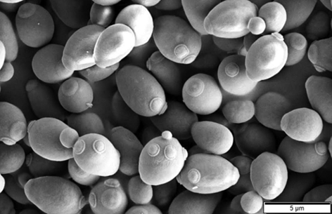 Saccharomyces_cerevisiaeHS Saccharomyces_cerevisiaeHS